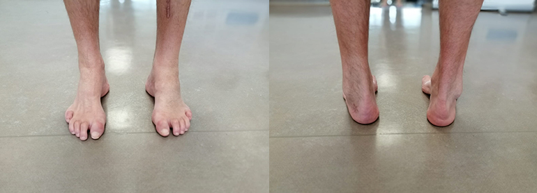 Stopala od spredaj in zadaj s supinacijo